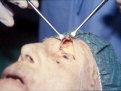 practicas de cirugia endoscopica